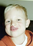 Tongue Trick